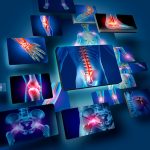 Rehabilitation Aids